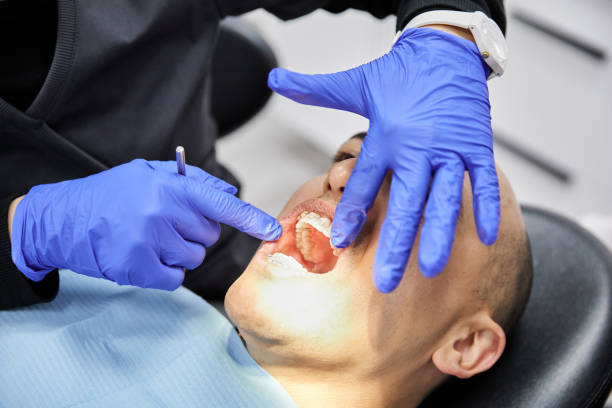 Best Emergency Dentist for Knocked-Out Tooth in Comfort, TX