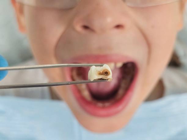 Best Urgent Dental Care for Toothache in Comfort, TX